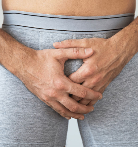 balanitis