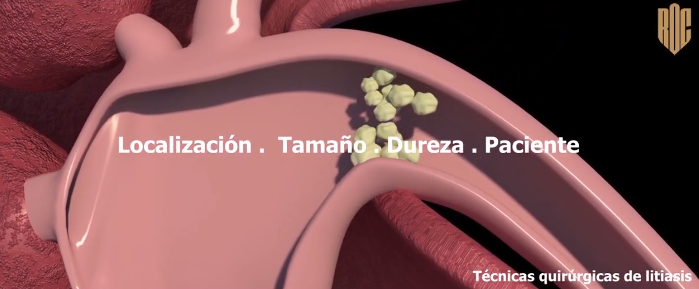 Portada Vídeo