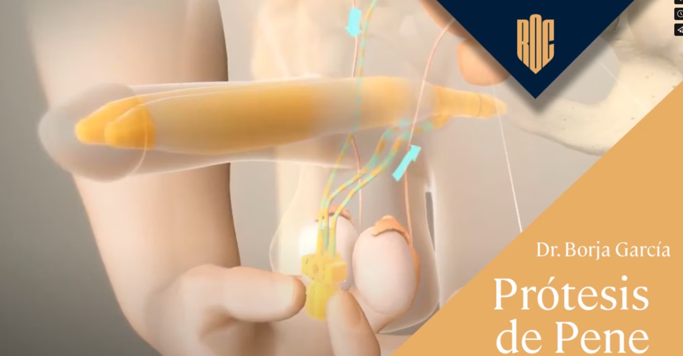 Portada Vídeo
